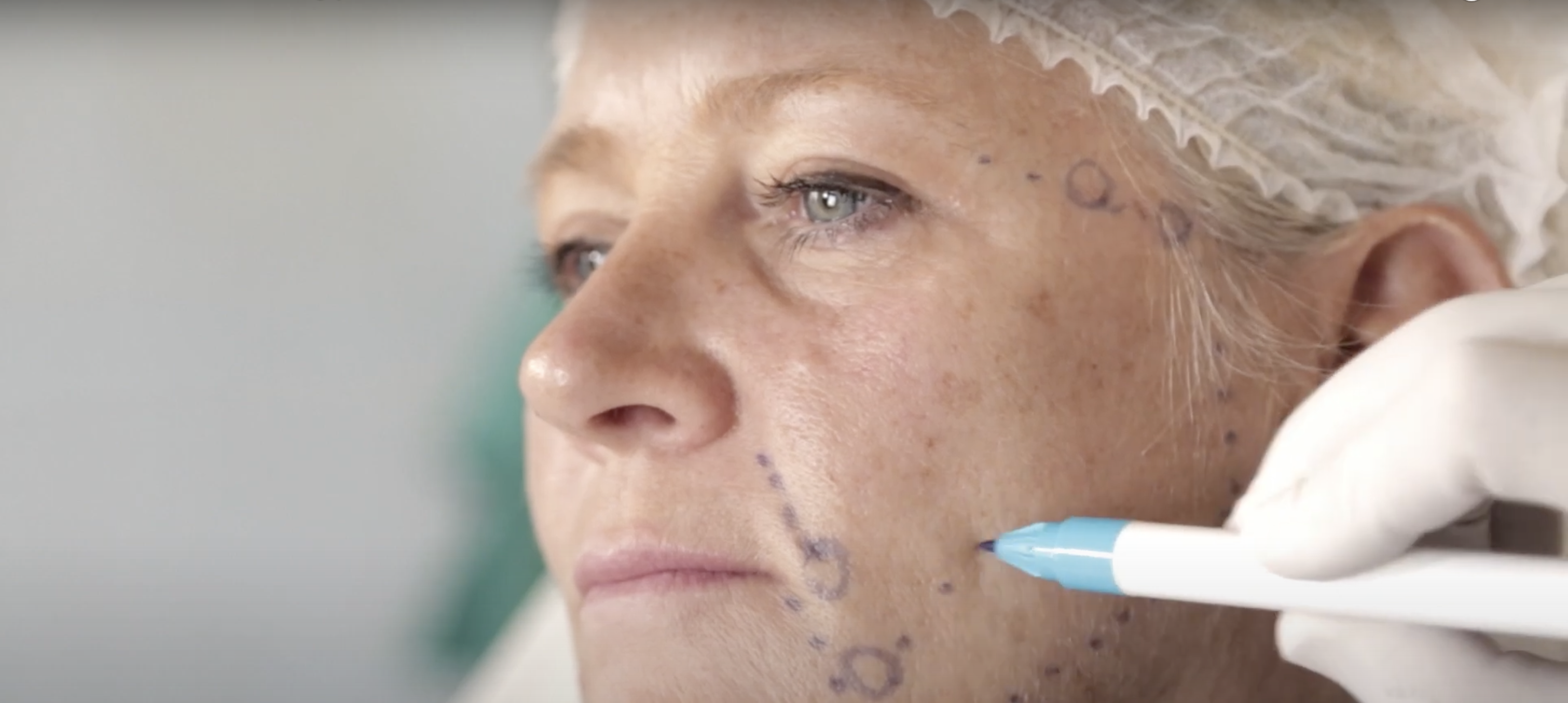 fils tenseurs lausanne